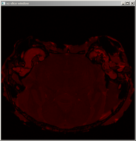 Nom : redBrain.png
Affichages : 233
Taille : 183,8 Ko